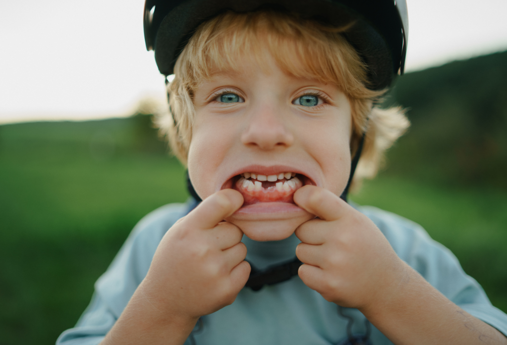 Young boy showing off his missing front teeth